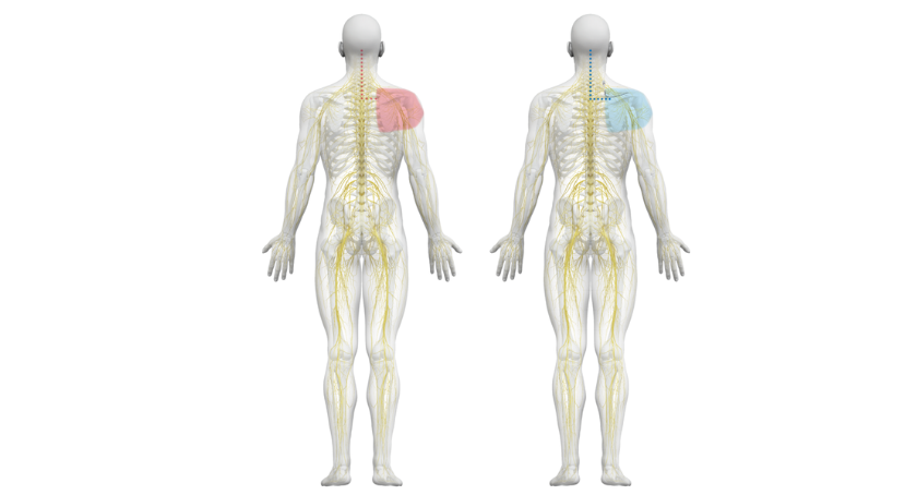 Nalu Medical Wins Aetna Coverage for its PNS Therapy